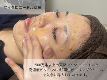 ホソナル(HOSONAL)/マイクロニードルピーリング