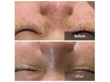 フェイス フェイス(FACE×FACE)の雰囲気（ソフトダーマで老けない理想の肌へ）