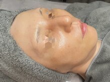 マノア(manoa.)の雰囲気(50代 ラピエラピーリング 2回目ツヤ、ハリ、透明感が蘇ります)