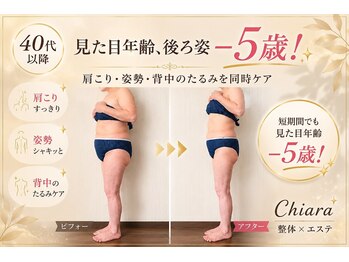キアラ(Chiara)の写真/【痩せたいのに変われない大人女性へ】温めてほぐして引き締める全身痩身ケア♪首肩こり・姿勢のお悩みも◎