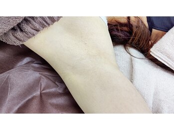 クレインクレイン(crane crane)/女性　オーダー脱毛【脇】