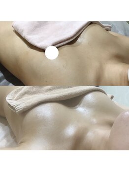 エヌエー(na)/大きさ・左右差・下垂