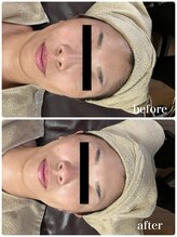 ジャスミン(Jasmin)/バリア機能改善ケア