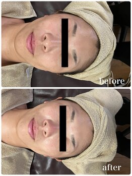 ジャスミン(Jasmin)/バリア機能改善ケア