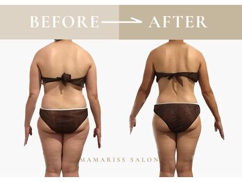 ママリスサロン(Mamariss Salon)/【骨盤×デトックス×痩身】
