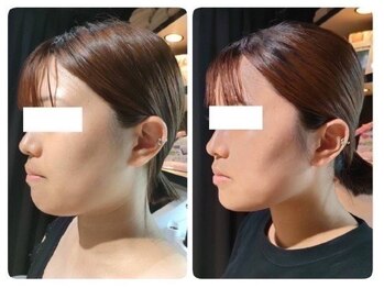 ガーデン(Garden)/レモンボトル1