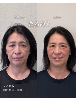 フェアリーフェイス 南森町店(Fairy Face)/南森町/顔の整体　疲れ顔解消