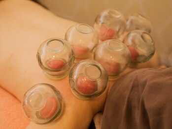 もみの木/身体の疲れ改善。本格的な吸い玉