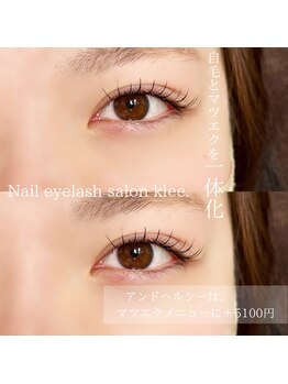 クレー(Klee)/アンドヘルシー