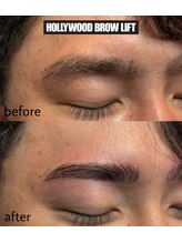 ヴィシアス(VIXIAS)/ハリウッドブロウリフト