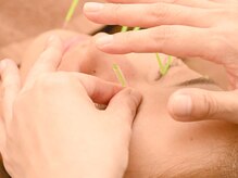 三和旭が丘院/眼精疲労美容鍼