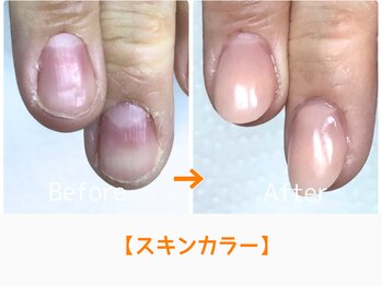 レアム/もう手元は隠さない。