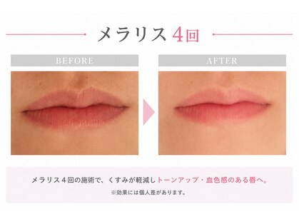 ラリリー(La Lily)の写真