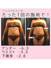 エクレボーテ(ECOULERBEAUTE)/リンパアビヤンガ