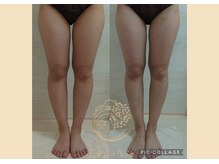 カロニア(CaLoNia)/骨格×脂肪アプローチ