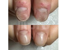エマネイル(emma nail)