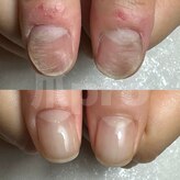 エマネイル(emma nail)