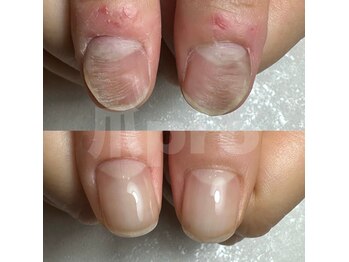エマネイル(emma nail)
