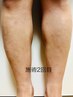 【Men's脱毛/人気No2】足脱毛　￥7000