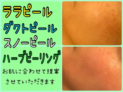 オンリーホープ(ONLY HOPE)の写真