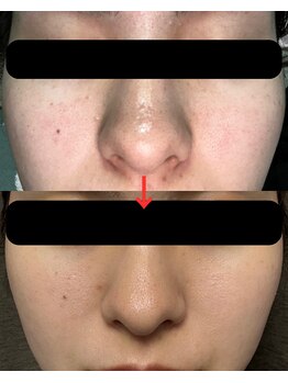 トモニ(TOMONI)/肌質改善サロン　TOMONI