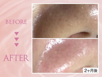 クリアラボ 池袋2nd(Clear Lab)/韓国肌管理&毛穴洗浄専門店