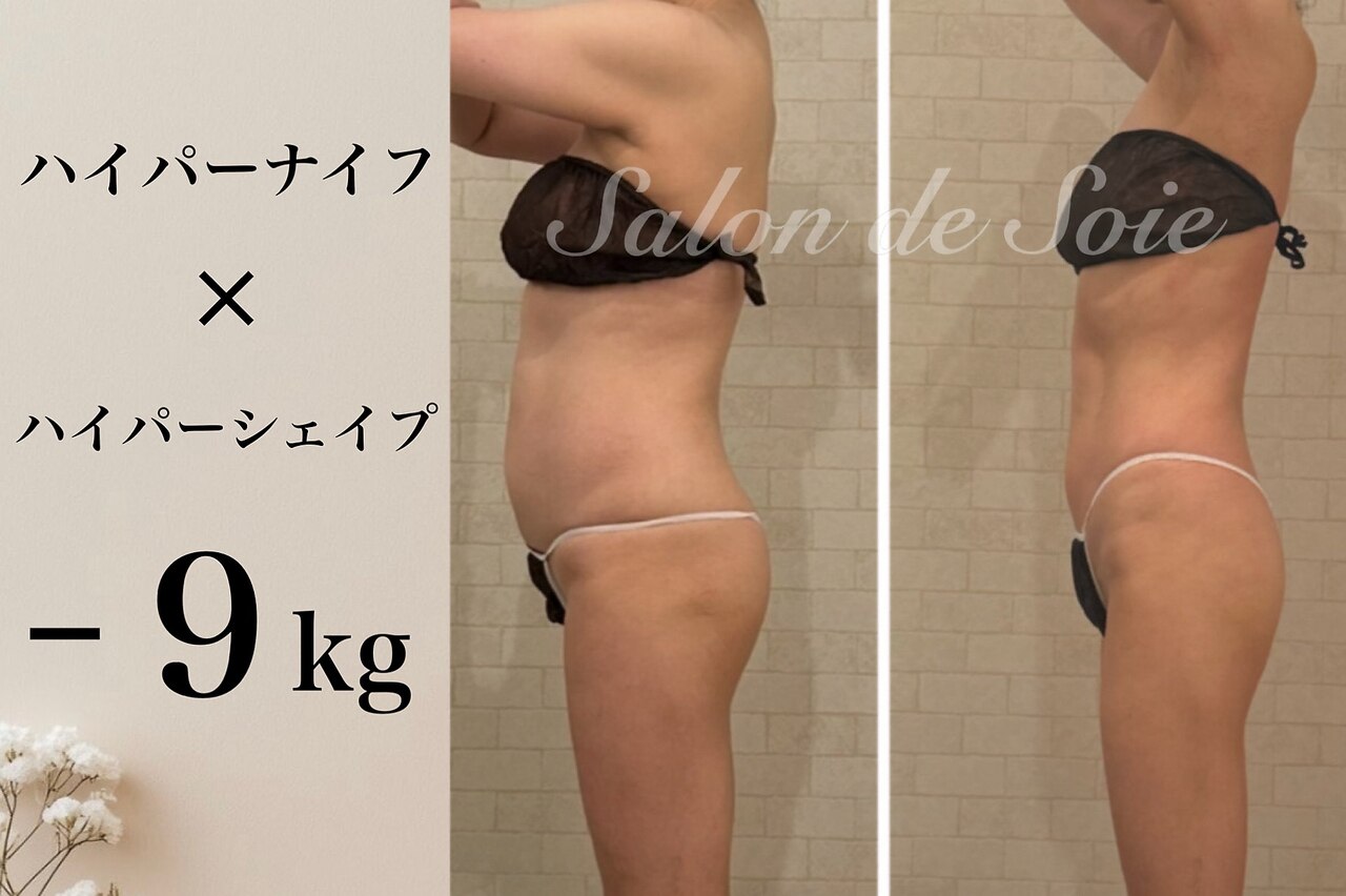 サロン ド ソワ(Salon de Soie)｜ホットペッパービューティー