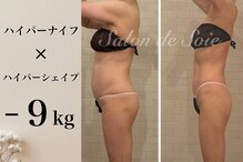 サロン ド ソワ(Salon de Soie)