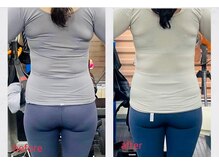 リリィ(RIRY)/【痩身ビフォーアフター】