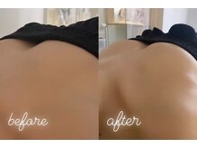 エムプリュ 心斎橋店(M.plus)/バストアップコース3回目