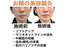 鍼灸サロンオランジュ 高槻富田院/