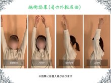 ボディ リセット アンド デザイン(Body Reset & Design)/【施術例】ビフォーアフター
