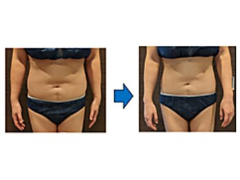 ローブメール(Robemail)/ビフォーアフター