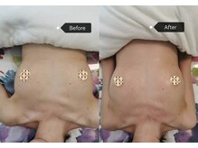 シークレット(Secret)/バストアップ