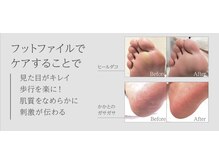 フットネイル種類豊富◎ケアや角質除去もおすすめ