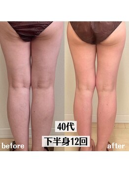 グラチア(Gratiae)/