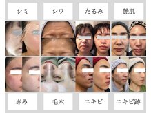 アルル 甲賀(ARuru)