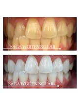 佐賀ホワイトニングラボ/