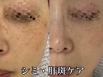 ビジュツ(BIJYUTSU)の写真