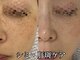 ビジュツ(BIJYUTSU)の写真
