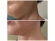 トータルビューティサロン リボーテ(Re:Beaute)の写真