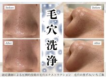 イミュ(Imyu.)