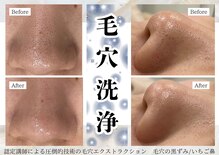 イミュ(Imyu.)