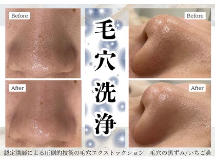 イミュ(Imyu.)の写真