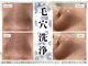 イミュ(Imyu.)の写真