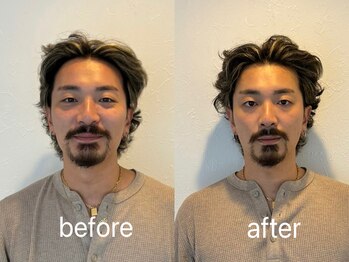 ラ カルナベル(La Carnabel)/美容鍼/耳つぼジュエリー/小顔