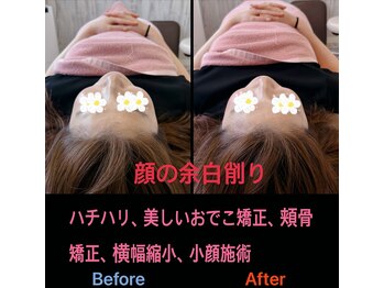 美容矯正サロン レレポノ(LELEPONO)/