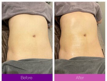 クレヴィア バイ サイバーエステ(CREBIA)/【お腹周り60分】