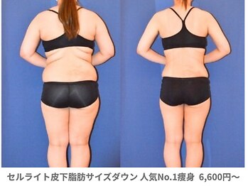 ピュアノア 三木店/痩身　三木/小野/西脇/加東/加西