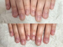 深爪矯正 爪悩み専門店 グラシナ 西宮北口店【4/3 NEW OPEN（予定）】/(深爪/長さだし/フィルイン)